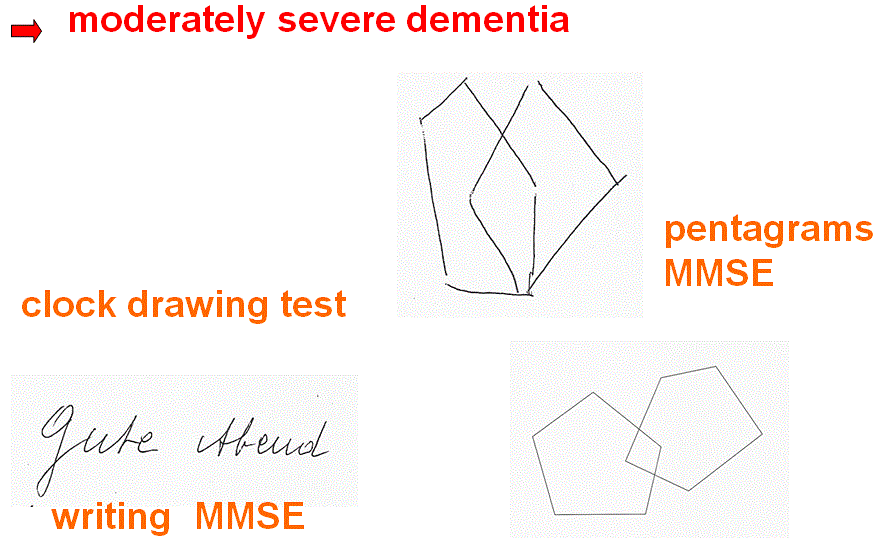 Moderately