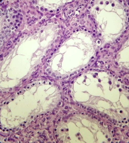 tubule
