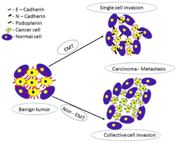cancer