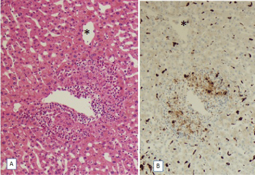 Sublobular