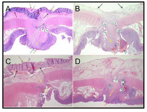 Histopathological