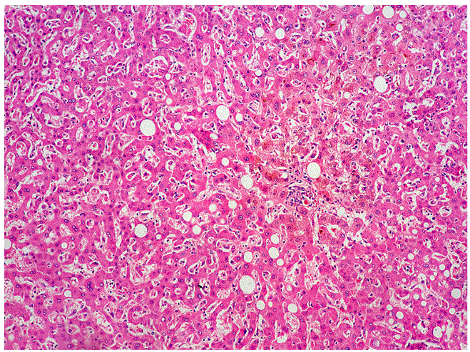 hematoxylin