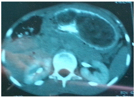 abdomen
