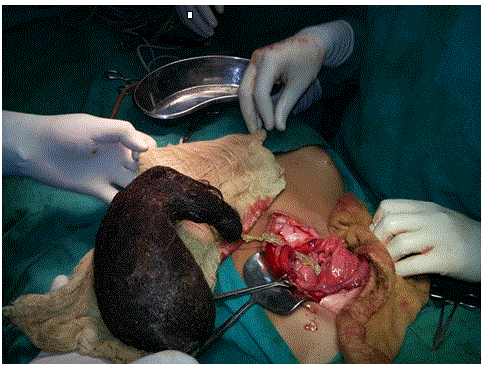 Extracted