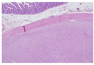 Gastrointestinal