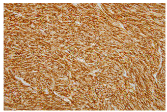 Immunohistochemical