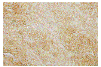 Immunohistochemical