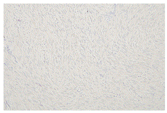 Immunohistochemical