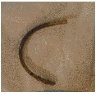 length