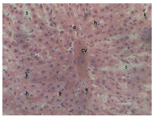 Photomicrograph