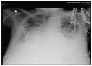 radiograph
