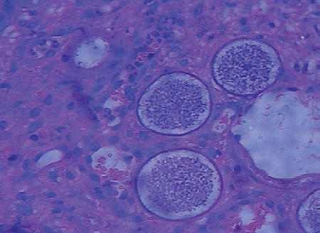 sporangia