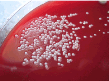 Bacteria