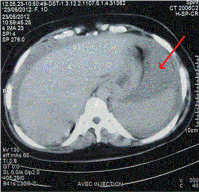 hepatic