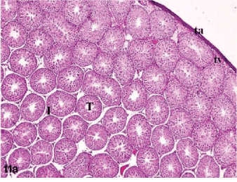Photomicrograph