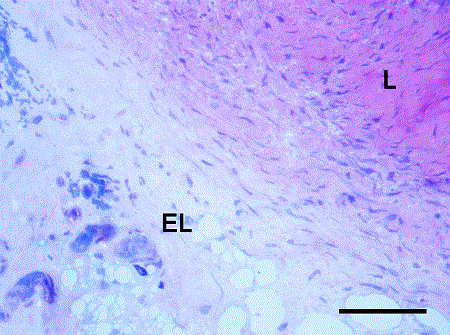 Epiligament
