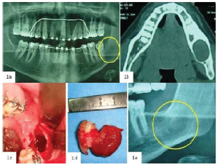 unilocular