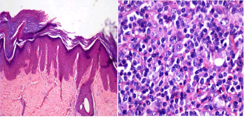 Histopathology