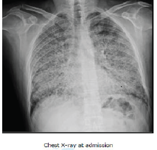Chest