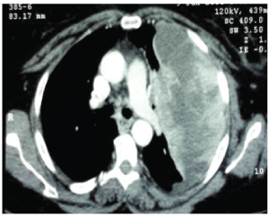 CT-scan