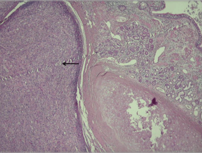 Pulmonary