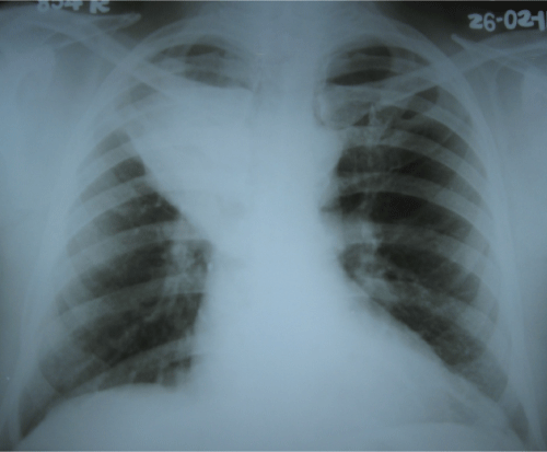 Figure 1 Figure 1