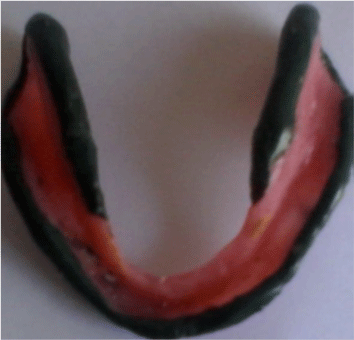 labial