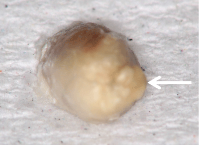 Stereomicroscopic