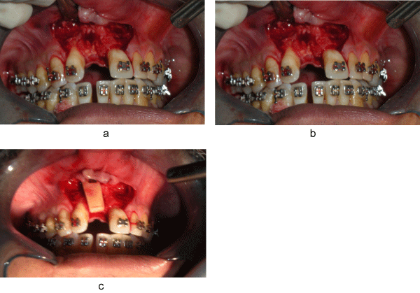 Surgical
