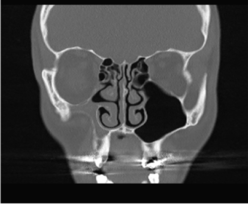 radiological