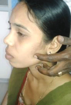 Palpation