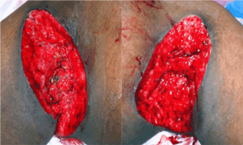 surgical
