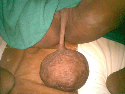 Position looks huge vulva pics outfit sexy