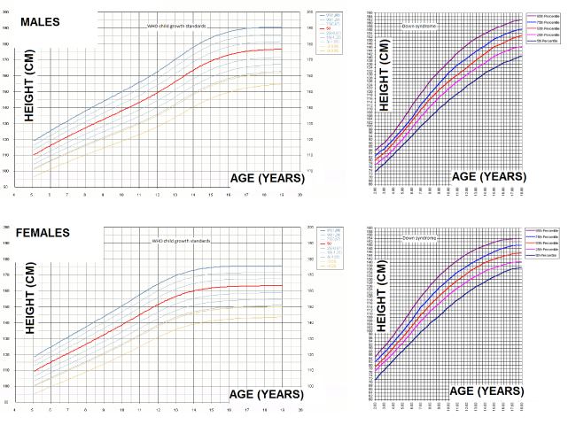 Trisomy 21 Growth Chart