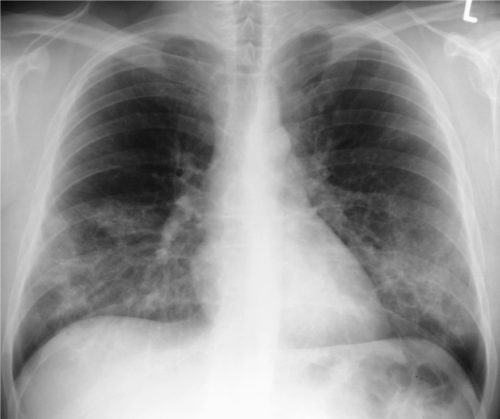 diffuse