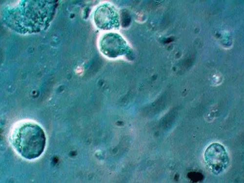 bk diamond cells