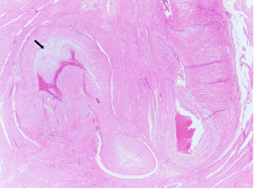 Histologic