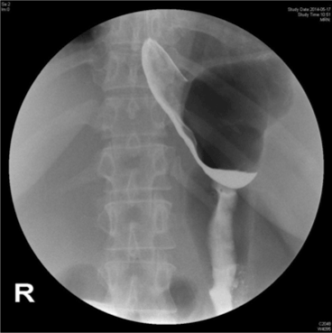fundus