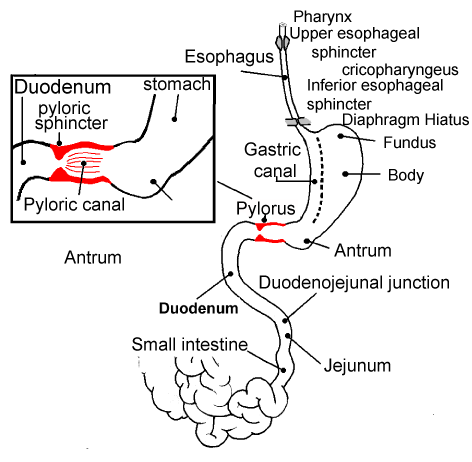 Pathophysiology Of Pyloric Stenosis In Flow Chart