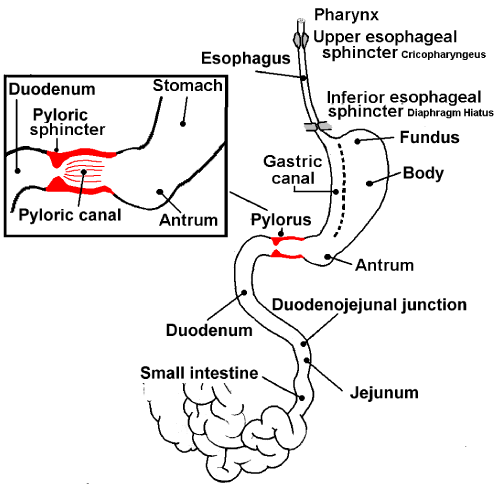 Pathophysiology Of Pyloric Stenosis In Flow Chart