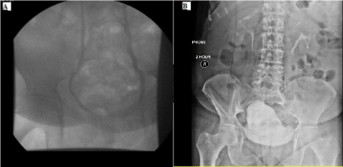 Preoperative