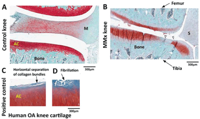 articular