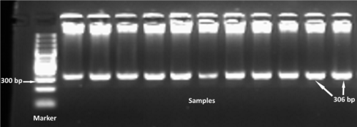 Electrophoresed