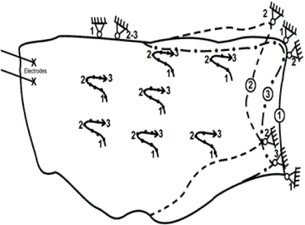 contraction