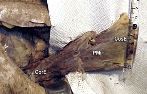 coracoid