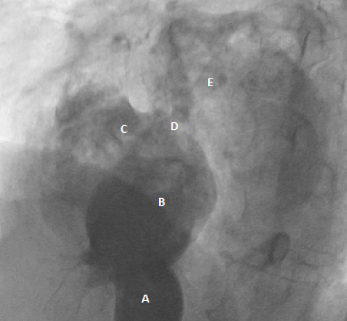 Cardiac