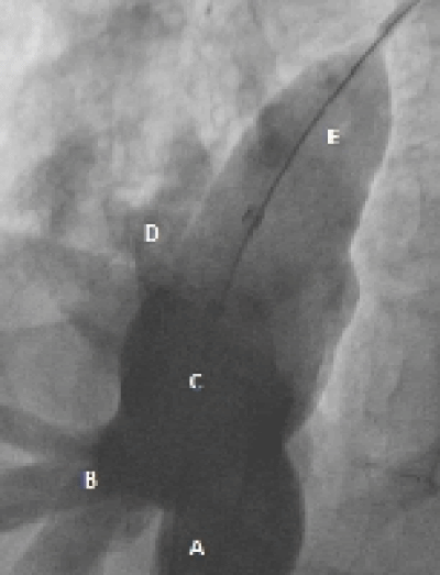 Cardiac