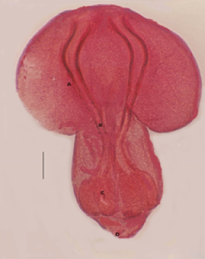 bisulcata