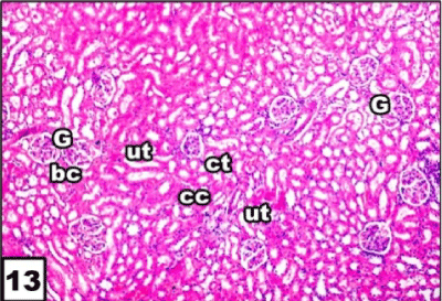 Photomicrograph
