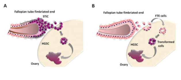 Fallopian